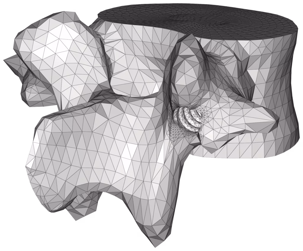 CM2 Intersect® T3 - Vertebra minus implant. Boolean operation.